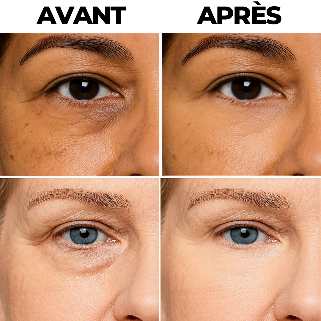 Illuminateur Contour des Yeux